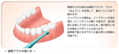 歯間ブラシ 歯間ブラシ