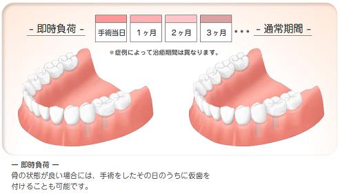 腫れが出血が少ない 腫れが出血が少ない